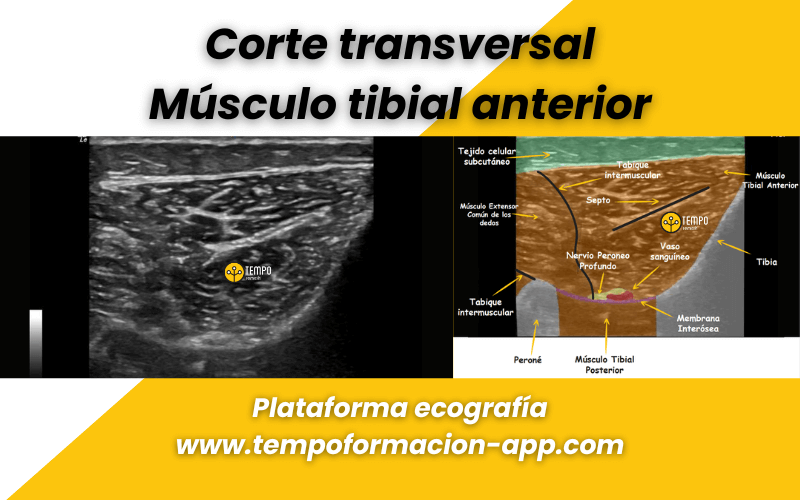 3. Anatomia ecografica Tempo Formacion.png